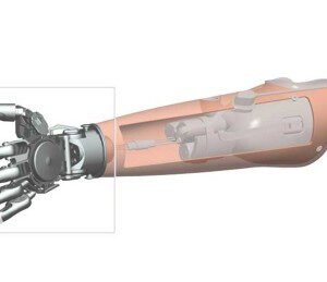 Sistema Michelangelo