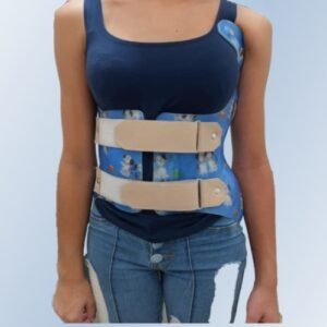 Colete para Escoliose Idiopática - Colete Rigo Chêneau